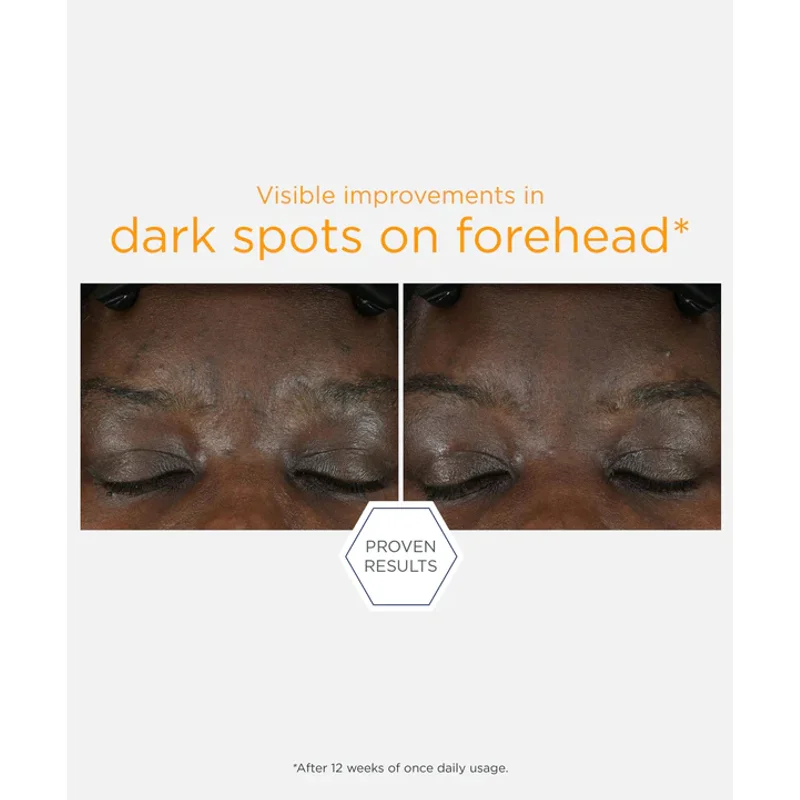 NeoStrata 15% Vitamin C + PHA Serum — view 4