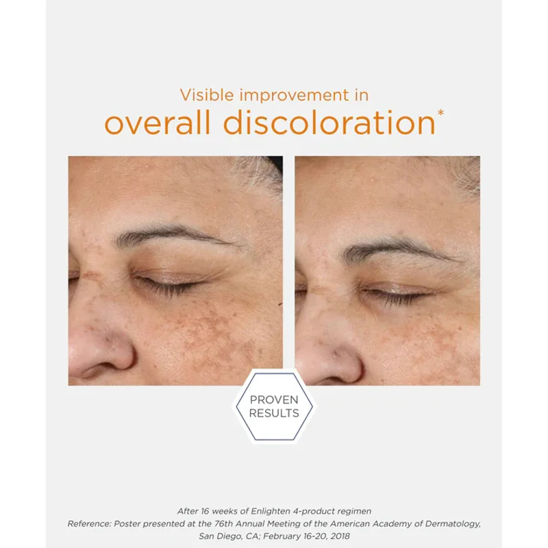 NeoStrata Enlighten Pigment Controller — view 5
