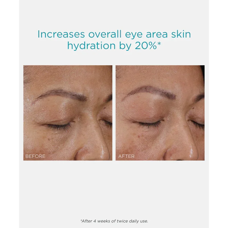 NeoStrata Eye Cream — view 4
